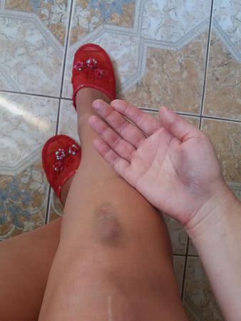 В Николаеве травмировалась девушка, которой по вине проводника пришлось на ходу выпрыгнуть из вагона поезда