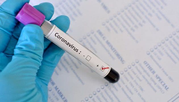 Статистика COVID-19 в Украине