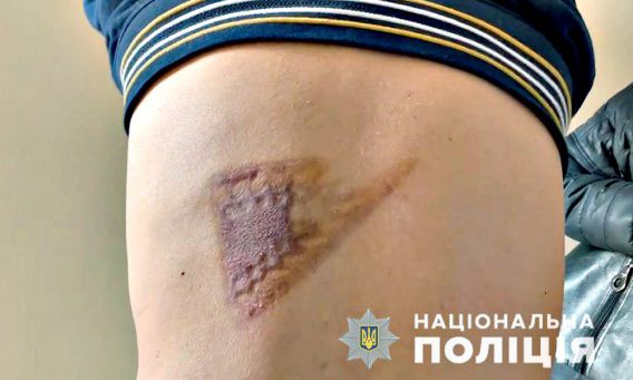 Николаевскую бизнесвумен задержали по подозрению в похищении людей и пытках