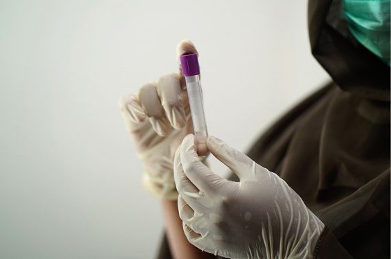 В приморском Очакове ни одного нового случая коронавируса за сутки