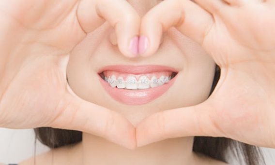 Самые распространенные мифы о брекетах