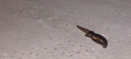 В николаевском баре подрались знакомые: один в больнице, другой в полиции