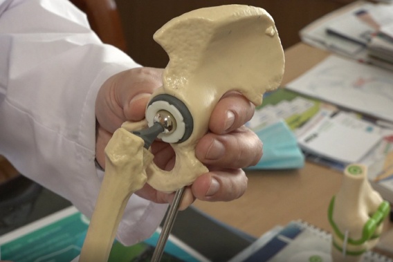 В 2021 году установили 71 имплант по николаевской ежегодной программе бесплатного эндопротезирования суставов