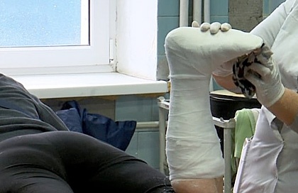 Гололед в Николаеве: люди массово обращаются в травмпункт