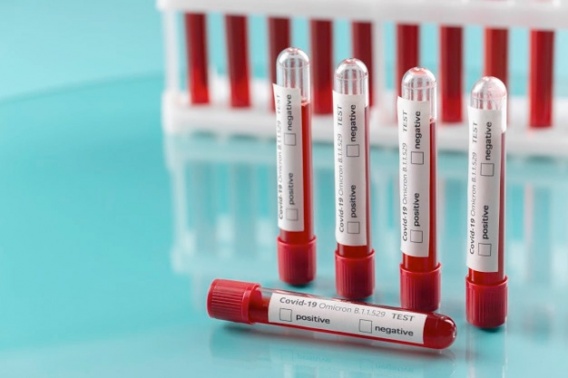 Первая украинка, заразившаяся штамом Omicron, уже болела ковидом