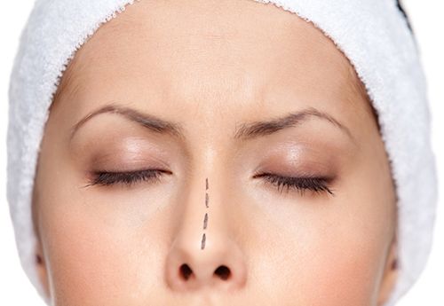 Искривленная носовая перегородка — нужно ли исправлять?