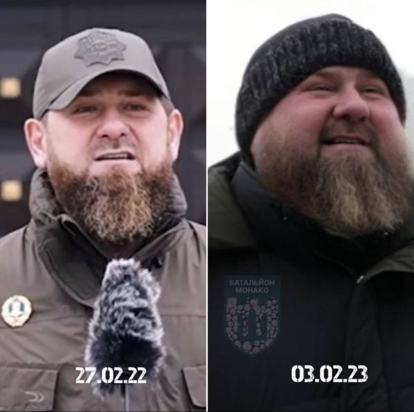 Кадырова неудачно прооперировали, у него все плохо, – Гудков