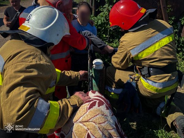 На Николаевщине мальчик перелезал через забор и проткнул ногу: спасателям пришлось срезать штыри