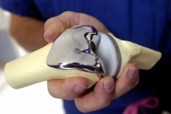 Как в Николаеве бесплатно заменить сустав: условия и порядок записи