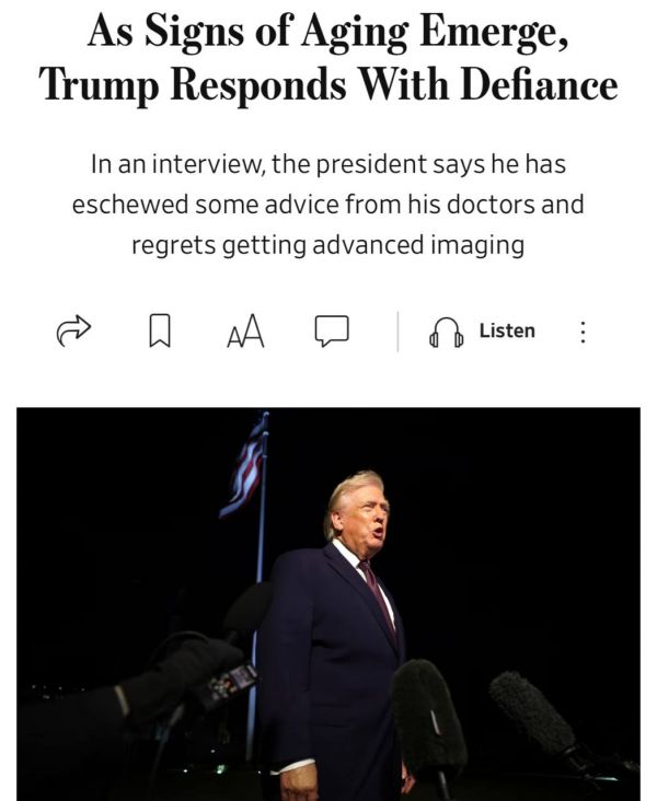 Трамп рассказал откуда у него синяки на руках