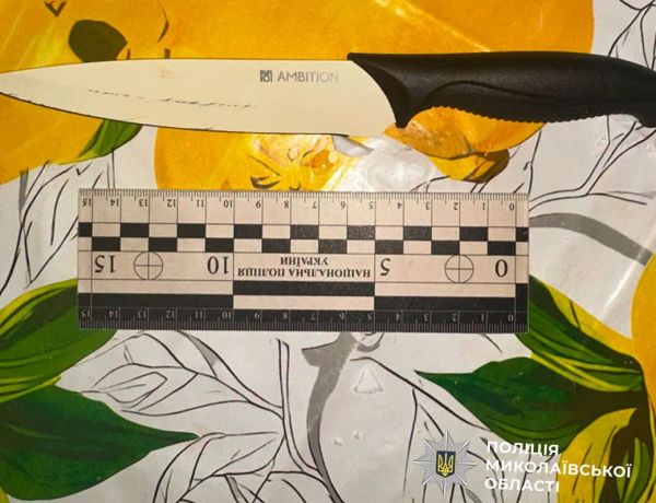 В николаевской многоэтажке две соседки устроили кровавую драку из-за собаки и ребенка
