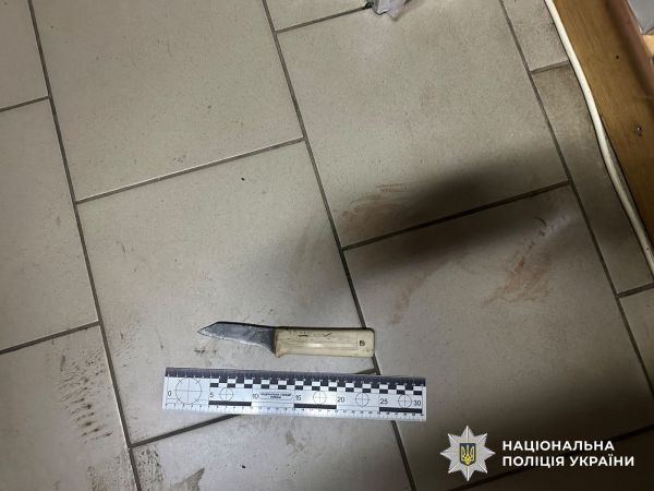 В Николаевской области ссора в магазине закончилась тяжелым ранением